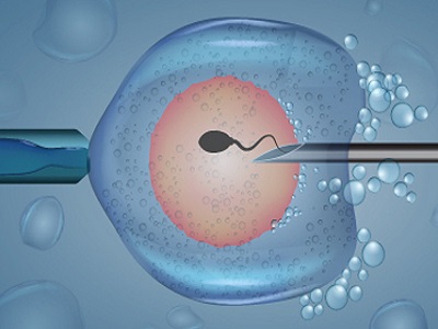 Best IVF Centre in Siliguri | IVF Cost in Kolkata | IVF in Siliguri